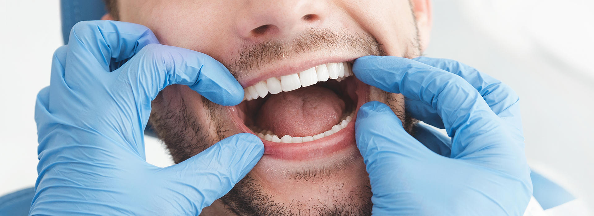 A man wearing blue gloves holds his mouth open while another person takes a photograph, likely in a dental or medical setting.